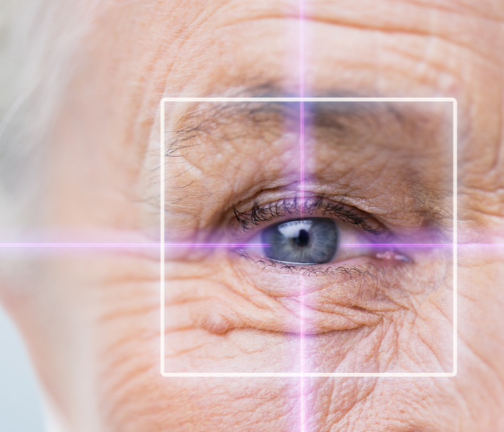 Older woman's eye close up with a laser graphic over it